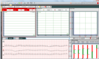 EC-3H kanal EKG Holter Sistemi
